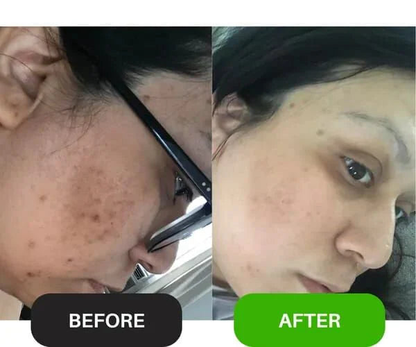 Wiki Special Skin Polish